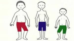 Hasil Intervensi Serentak Temukan 1.598 Balita Stunting di Kota Padang