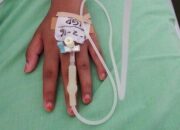 Gawat! Keracunan Makan Bergizi Gratis Terus Terjadi di Daerah, 2 Siswa Kritis