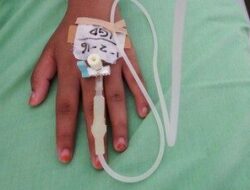 Gawat! Keracunan Makan Bergizi Gratis Terus Terjadi di Daerah, 2 Siswa Kritis